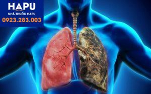 Vai trò của phương pháp xạ trị trong điều trị ung thư phổi